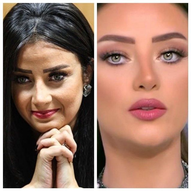 رضوى الشربيني تتعرّض للسخرية بسبب شكلها السابق والحالي
